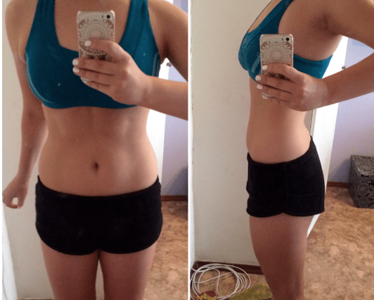 foto sebelum dan sesudah diet keto